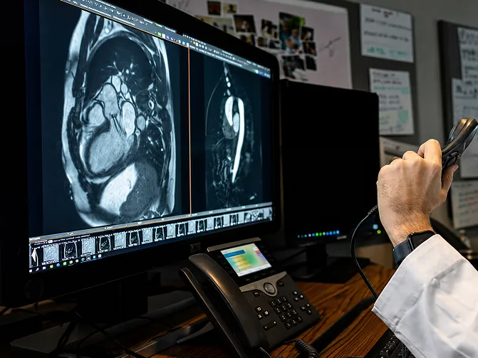 Cardiac MRI imaging of the heart at Lucent Medical Imaging in Glendale, California